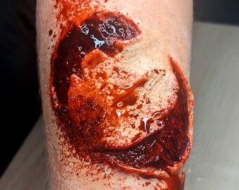 FX Wide bite prosthesis - silicone