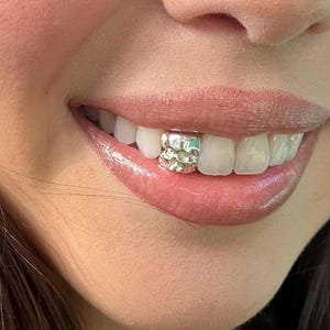 CUSTOM GRILLZ - Gold Silver Dental Caps Custom Made