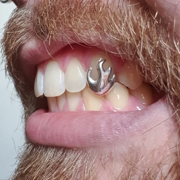 CUSTOM GRILLZ - Gold Silver Dental Caps Custom Made