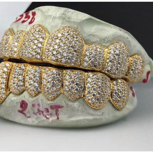 Solid 10K Gold Real Custom Cap Grillz Diamond Dust Two Tone Etsy