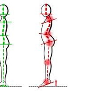 K&ouml;nnte beinhalten: Illustration, die eine gute K&ouml;rperhaltung mit einer schlechten K&ouml;rperhaltung vergleicht. Das Bild zeigt eine Strichm&auml;nnchen mit einer geraden Wirbels&auml;ule und eine Strichm&auml;nnchen mit einer gekr&uuml;mmten Wirbels&auml;ule, einem nach vorne geneigten Kopf und einem Hohlkreuz.
