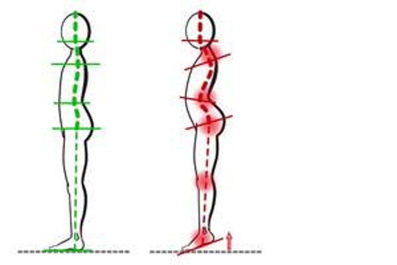 K&ouml;nnte beinhalten: Illustration, die eine gute K&ouml;rperhaltung mit einer schlechten K&ouml;rperhaltung vergleicht. Das Bild zeigt eine Strichm&auml;nnchen mit einer geraden Wirbels&auml;ule und eine Strichm&auml;nnchen mit einer gekr&uuml;mmten Wirbels&auml;ule, einem nach vorne geneigten Kopf und einem Hohlkreuz.