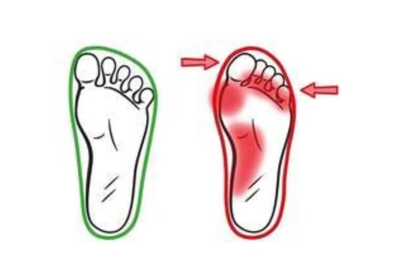 May include: Diagram of two feet, one outlined in green, the other in red. The green foot shows a normal foot shape. The red foot shows areas of potential pain, with arrows indicating pressure points.