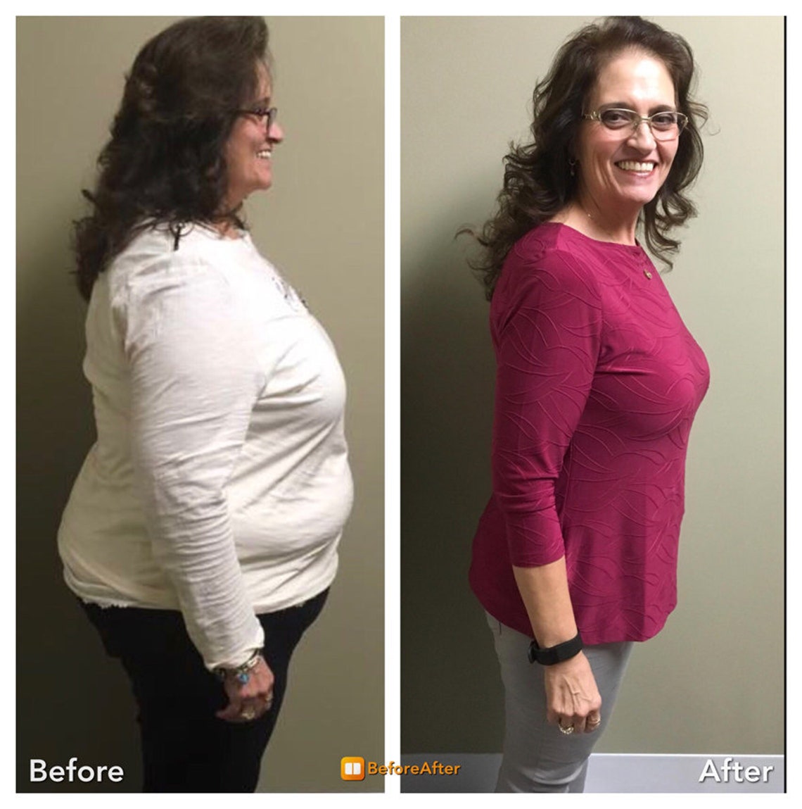 Semaglutide Lose Weight Transformation Packages 12month Etsy