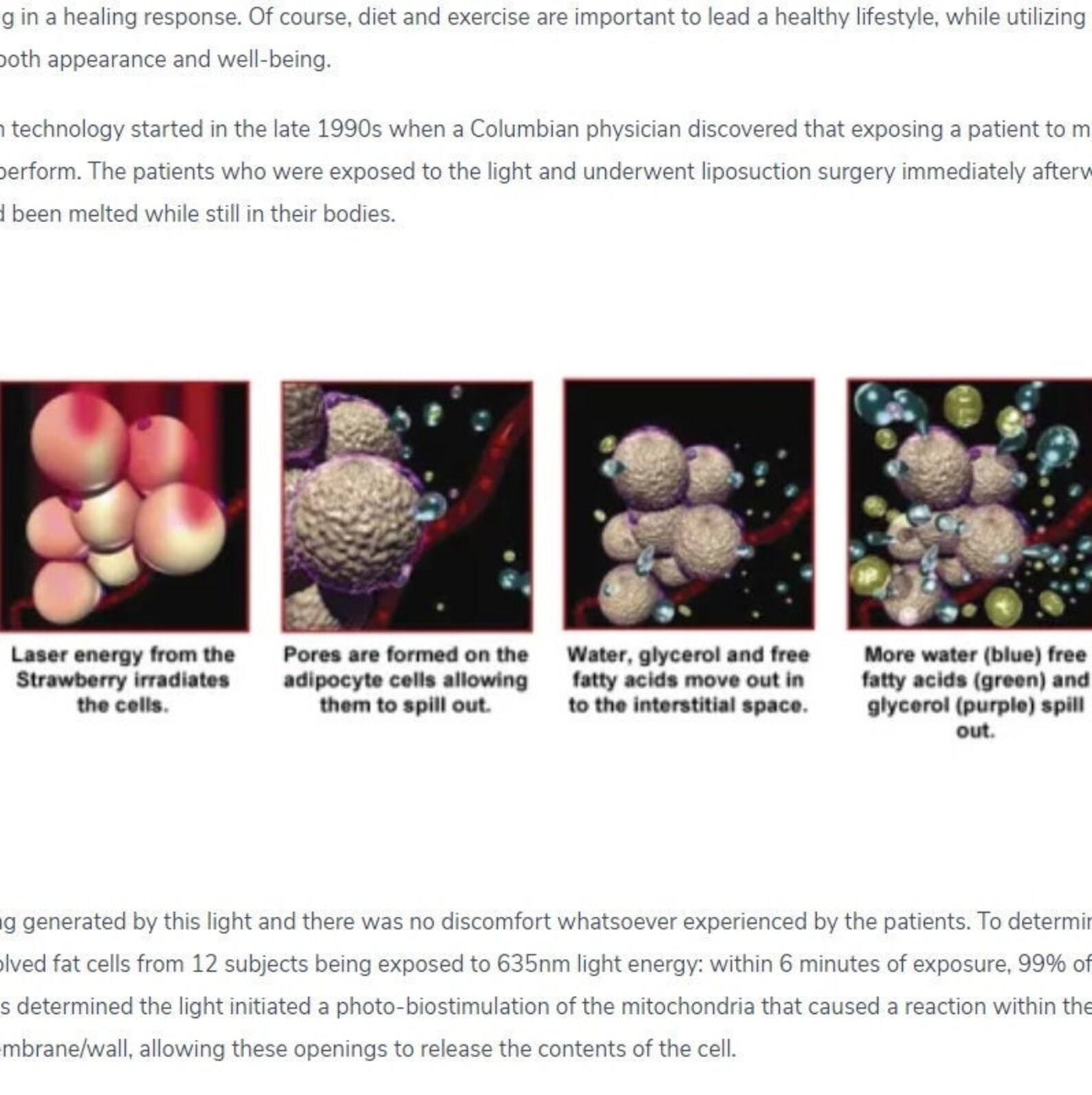 Lipo Laser Body Sculpting Training Course Body Contouring Etsy