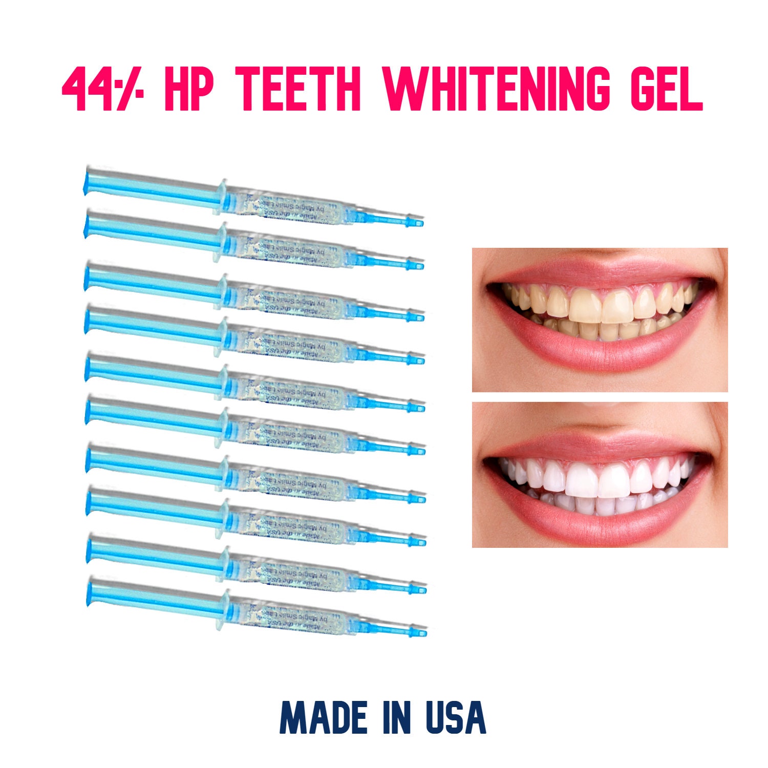 Extra High strength teeth whitening gel refills (44% hydrogen peroxide) in syringes (3 g each)