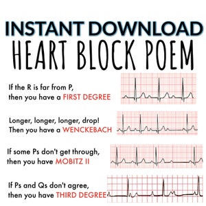 Puede incluir: Un diagrama que muestra diferentes tipos de bloqueo cardíaco con lecturas de ECG correspondientes. El texto dice: "Si la R está lejos de P, entonces tienes un PRIMER GRADO. Más largo, más largo, más largo, ¡caída! Entonces tienes un WENCKEBACH. Si algunos Ps no pasan, entonces tienes MOBITZ II. Si los Ps y los Qs no están de acuerdo, entonces tienes TERCER GRADO."