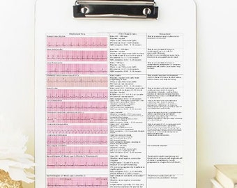 Nurse Clipboard with 13 Cardiac Rhythm and Dysrhythmias Cheat Sheet, Cardiac Rhythm, Cardiac Nurse Gift, Custom Clipboard, Clipboard Nurse