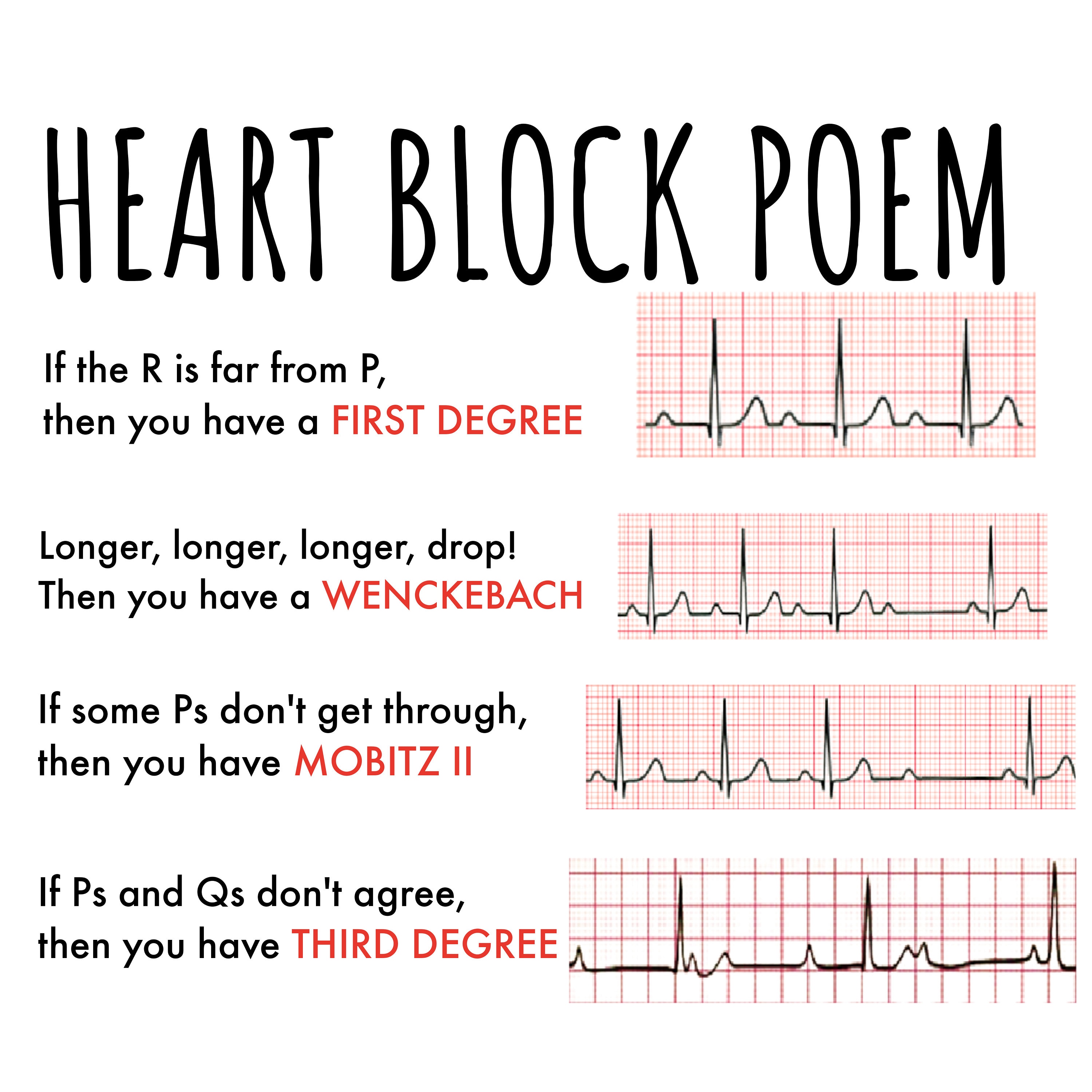 Cardiac Nurse Digital Download, Cardiac Rhythms for Nurse, Cardiac ...