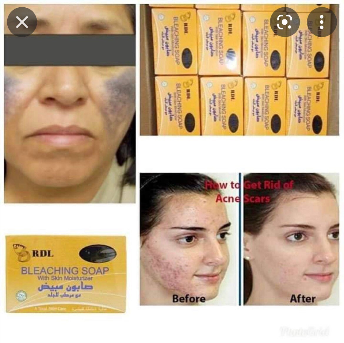 RDL Bleaching Face and Body Soap 135g Etsy