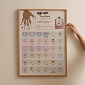 Poster Ayurveda-diagnose nageldiagnose + boekplanner invoegen, ayurveda-grafiek, ayurvedische diagnose vingernagel, afdrukbare alternatieve geneeskunde
