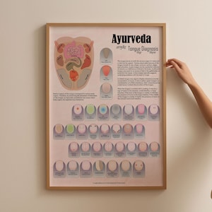 Ayurveda-tongdiagnose gedetailleerde grafiekposter, ayurveda-grafiek, tong- en organendiagnose, afdrukbare alternatieve geneeskunde