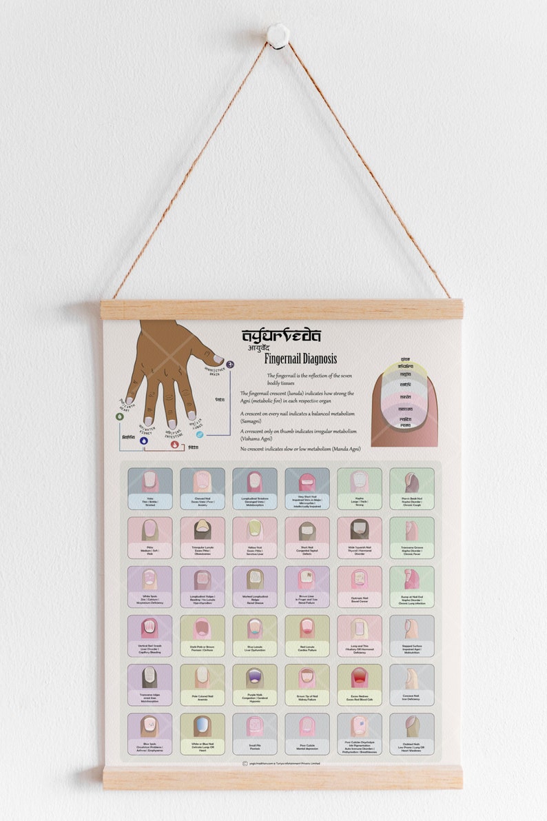 Ayurveda Nail Diagnosis Chart Poster Book Planner Insert, Ayurveda