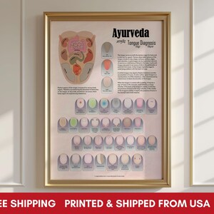 Ayurveda Tongue Diagnosis ungerahmt Poster, Ayurveda Chart, Zunge & Organe Diagnosis, Alternative Medizin, Premium Matte Papier Poster