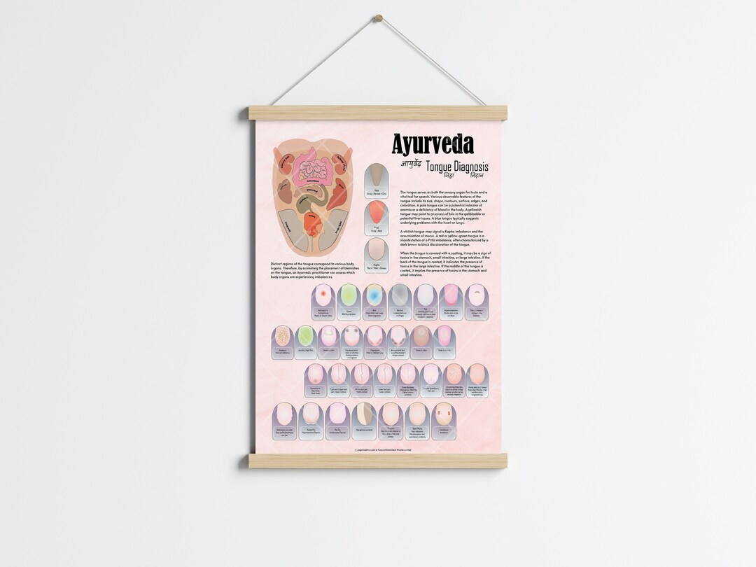 Ayurveda Tongue Diagnosis Detailed Chart Poster, Ayurveda Chart, Tongue & Organs Diagnosis