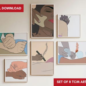 May include: Set of eight TCM art prints. Each framed print depicts illustrations of traditional Chinese medicine practices, including gua sha, acupuncture, and cupping. The words "DIGITAL DOWNLOAD" and "SET OF 8 TCM ART PRINTS" are visible.