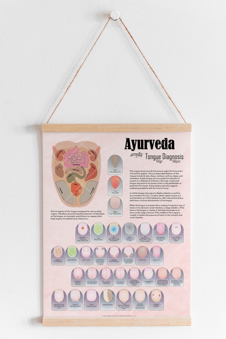 Ayurveda Tongue Diagnosis Detailed Chart Poster, Ayurveda Chart, Tongue