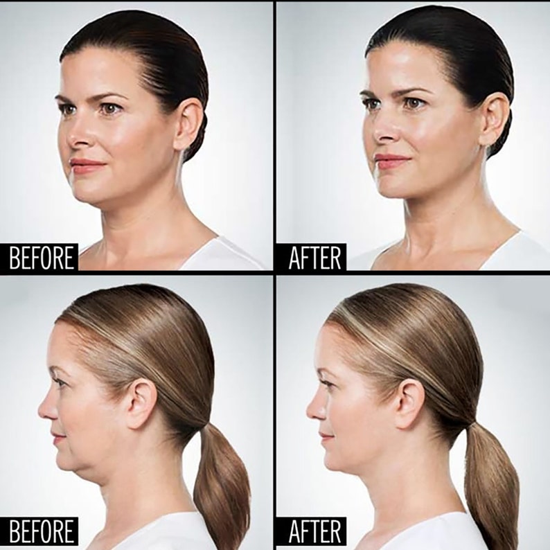 Remove Double Chin Body Slimming Face Contouring Photo Retouching