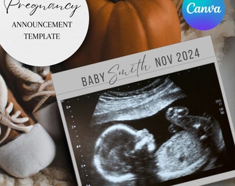 Puede incluir: Una plantilla de anuncio de embarazo con fondo gris y una imagen de ultrasonido en blanco y negro de un bebé. El texto "BABY Smith NOV 2024" está escrito en letra cursiva negra en la parte superior de la imagen.