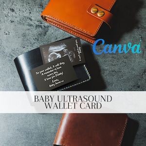 Regalo di gravidanza per papà / Non vedo l'ora di conoscerti Immagine ecografica / Biglietto di annuncio di gravidanza per il marito / Regalo per il nuovo papà / Modello Canva