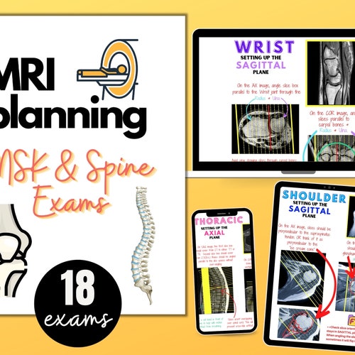 MRI Notes ARRT ARMRIT Study Guide Mri Registry Exam Mri Etsy
