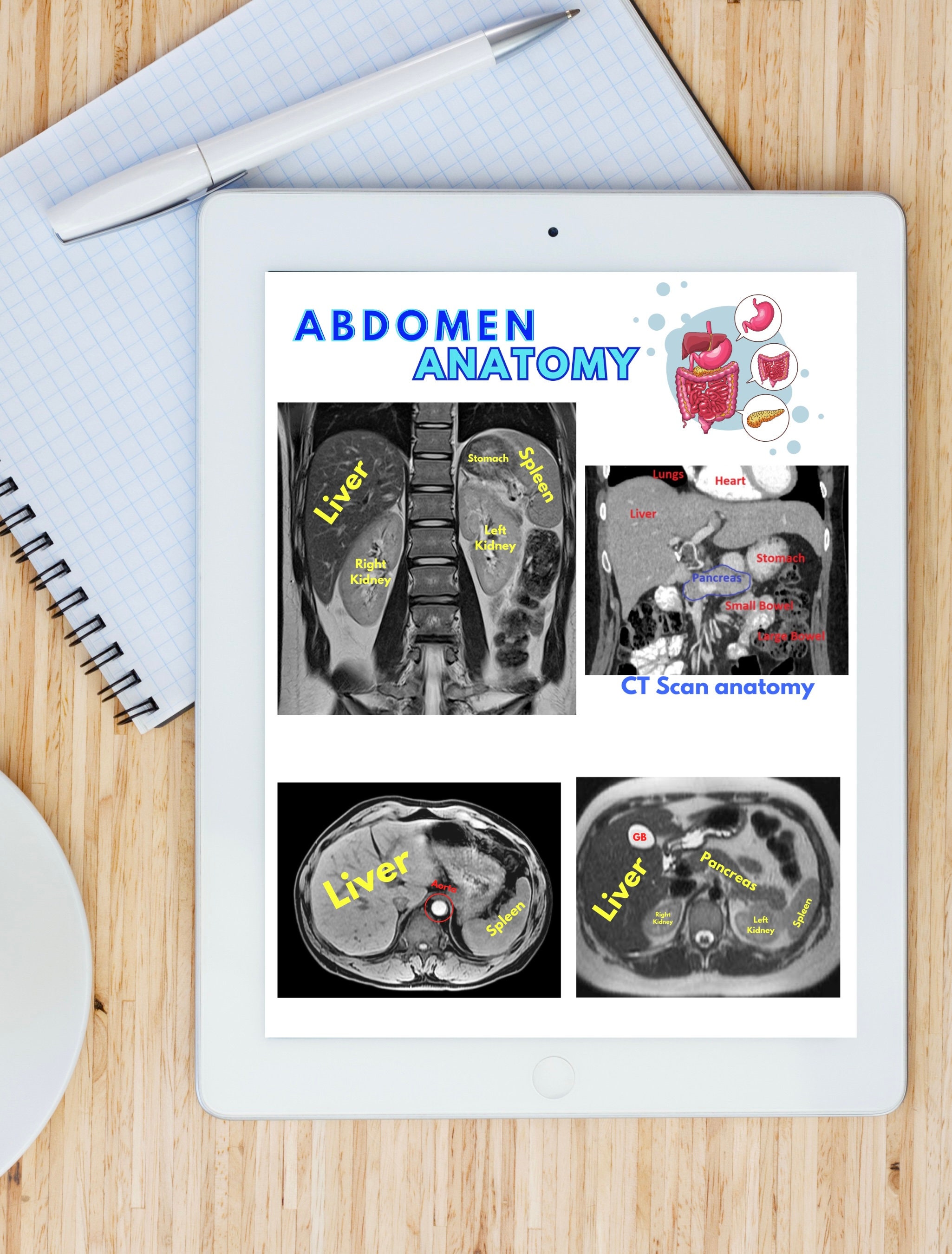 MRI Planning Chest and Abdomen, MRI Positioning, Mri, Mri Study Guide, Mri Notes, ARRT, Armrit