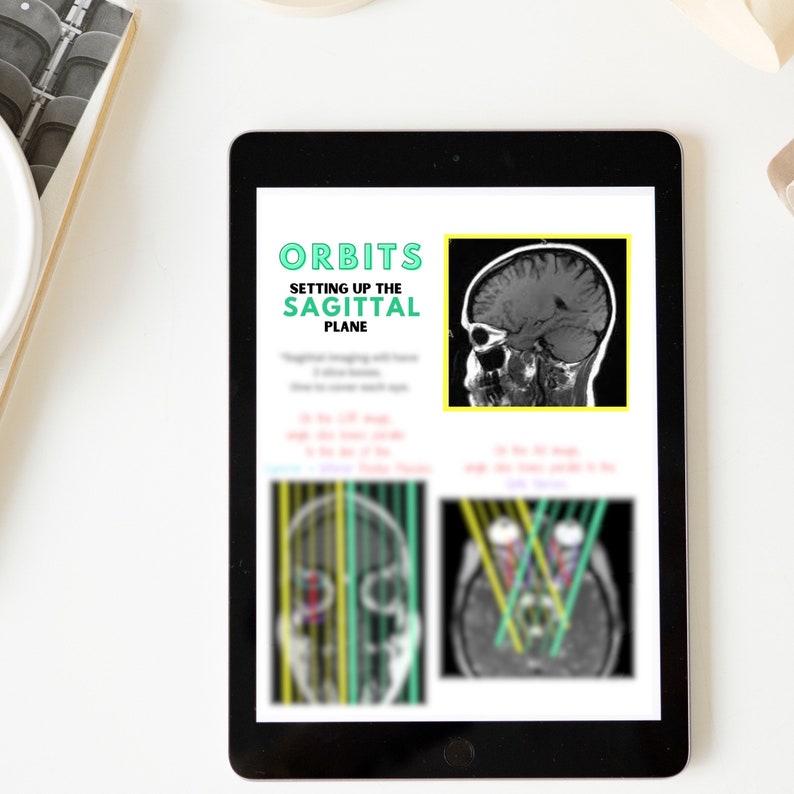 MRI Planning, MRI Positioning, Mri Neuro, Mri Study Guide, Mri Notes, ARRT, Armrit, Mri Tech