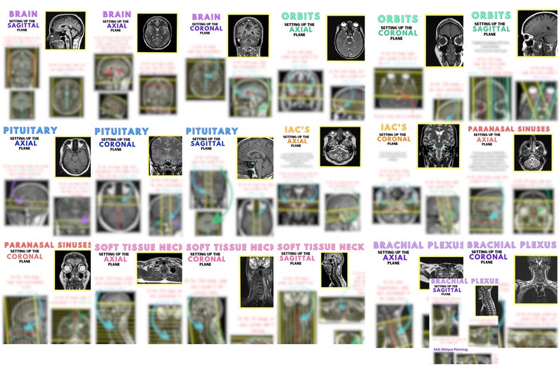 MRI Planning, MRI Positioning, Mri Neuro, Mri Study Guide, Mri Notes, ARRT, Armrit, Mri Tech