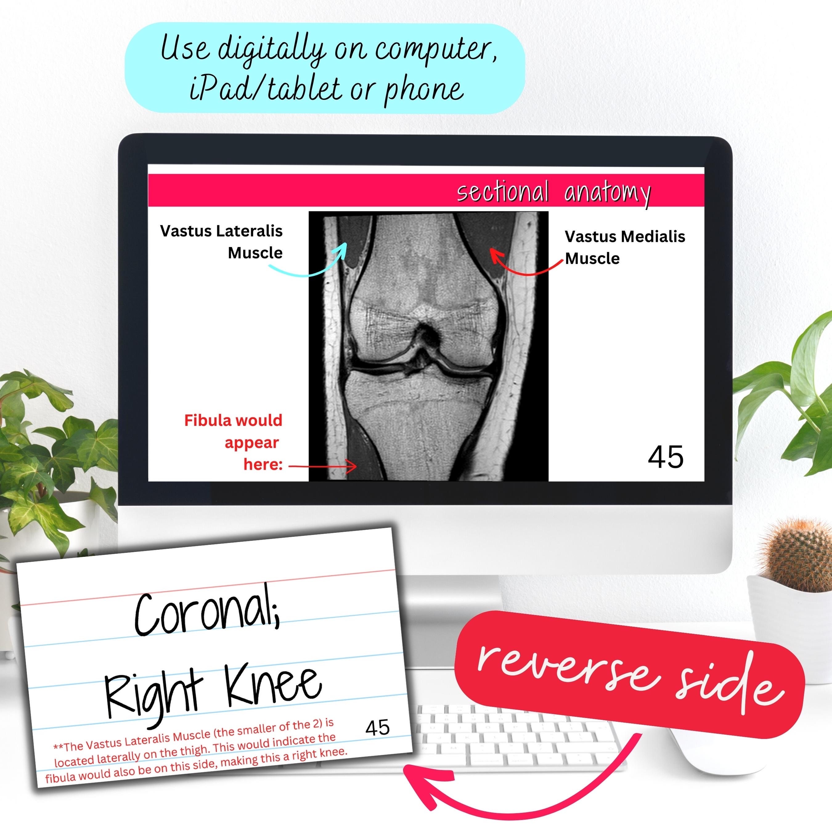 MRI Sectional Anatomy Flashcards, 96 Cards (digital Download) - Etsy
