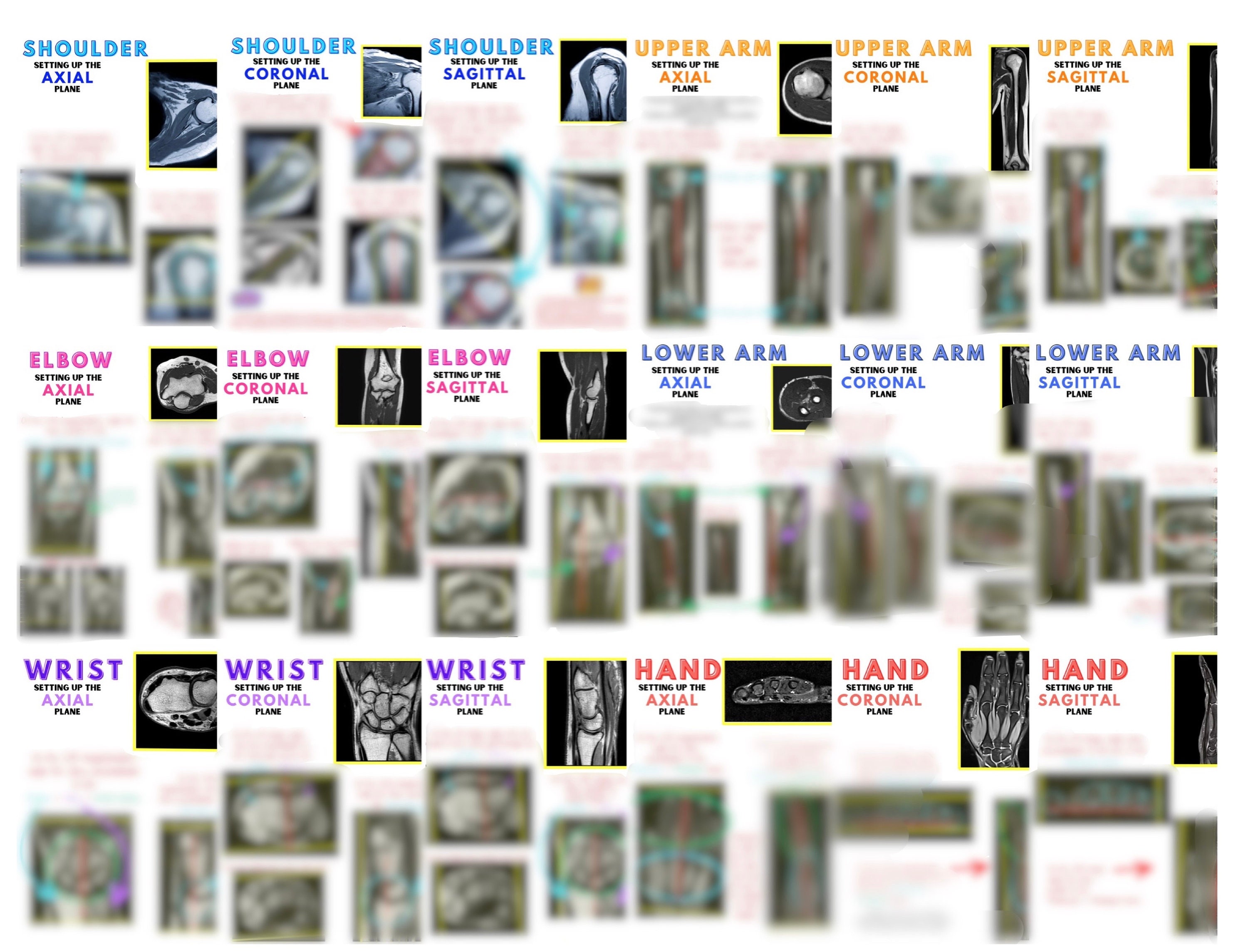 MRI Planning, MRI Positioning, Mri, Msk, Mri Study Guide, Mri Notes, ARRT, Armrit, Mri Tech