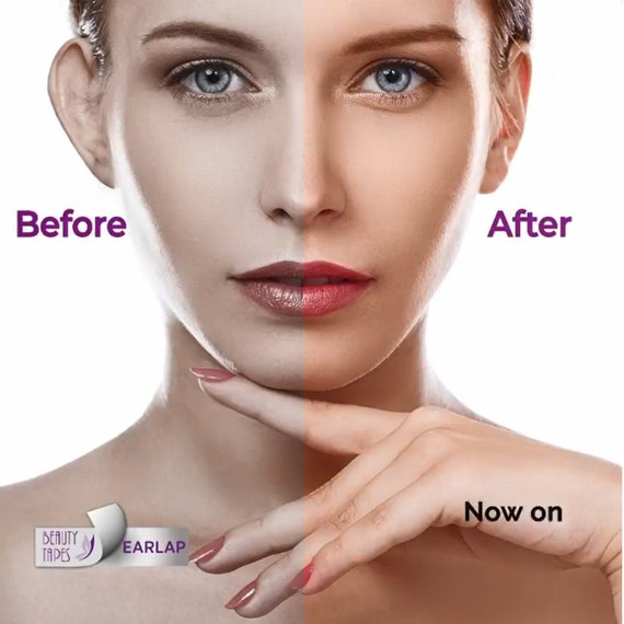 Earlap Ear Concealer Aesthetic Instant Effect Sticking for