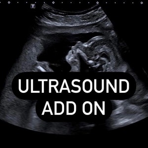 Ultrasound Personalization Add On