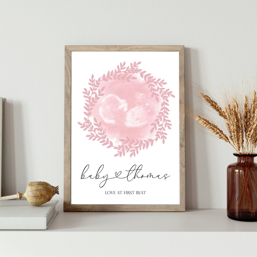 Ultrasound Print Art Watercolor Ultrasound Print Custom Etsy