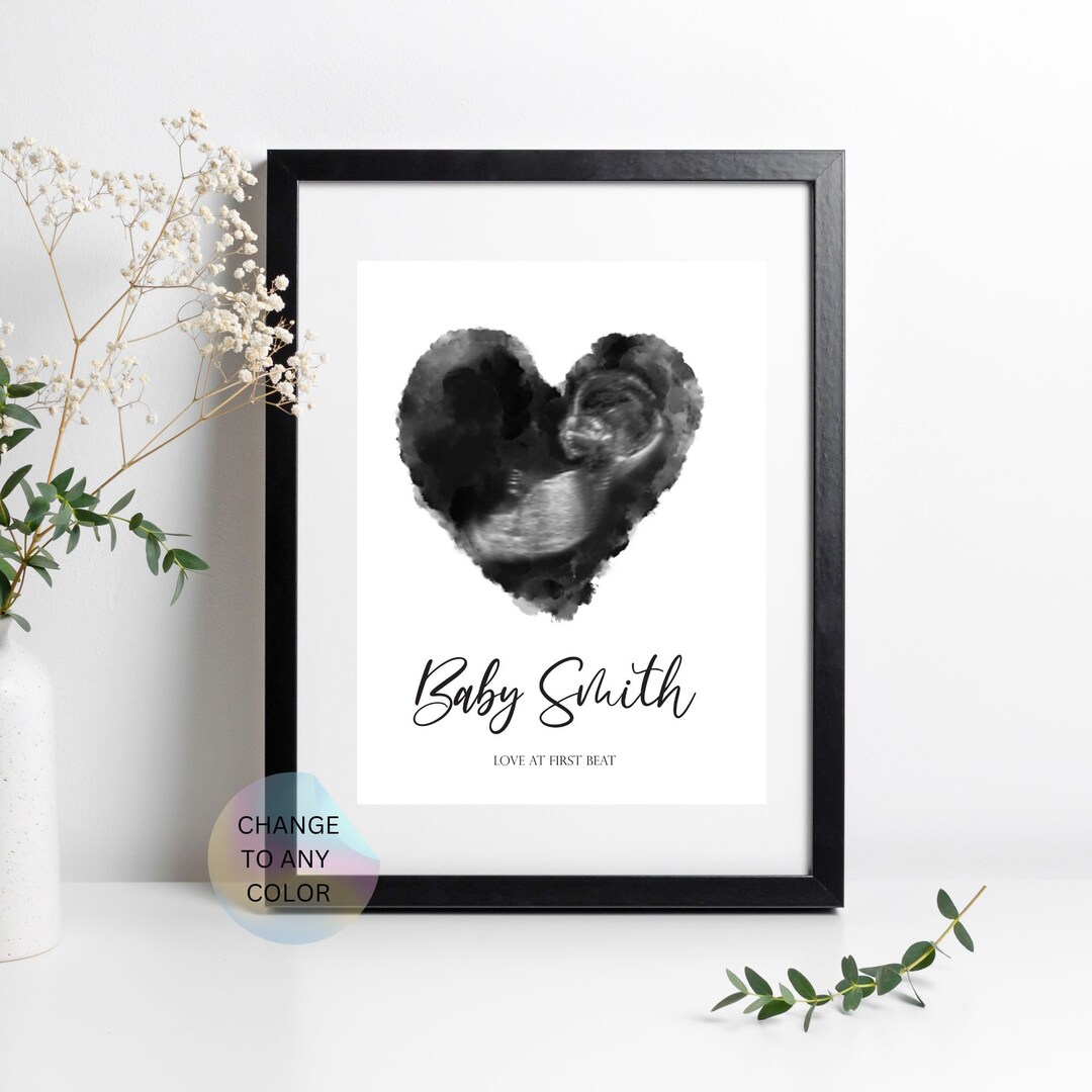 Ultrasound Print Art Watercolor Ultrasound Print Custom Etsy