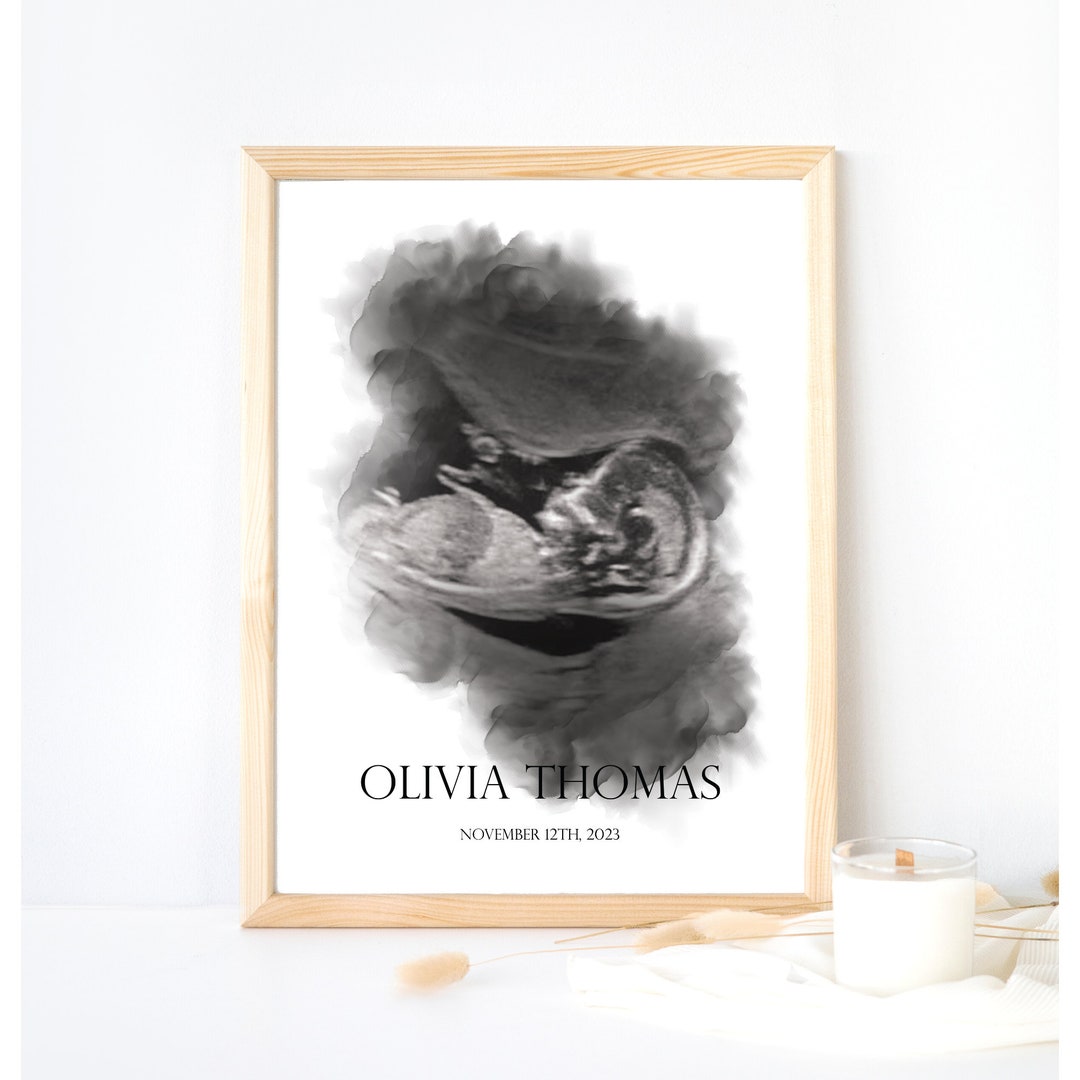 Ultrasound Print Art, Watercolor Ultrasound Print, Custom Birth Keepsake, Nursery Print