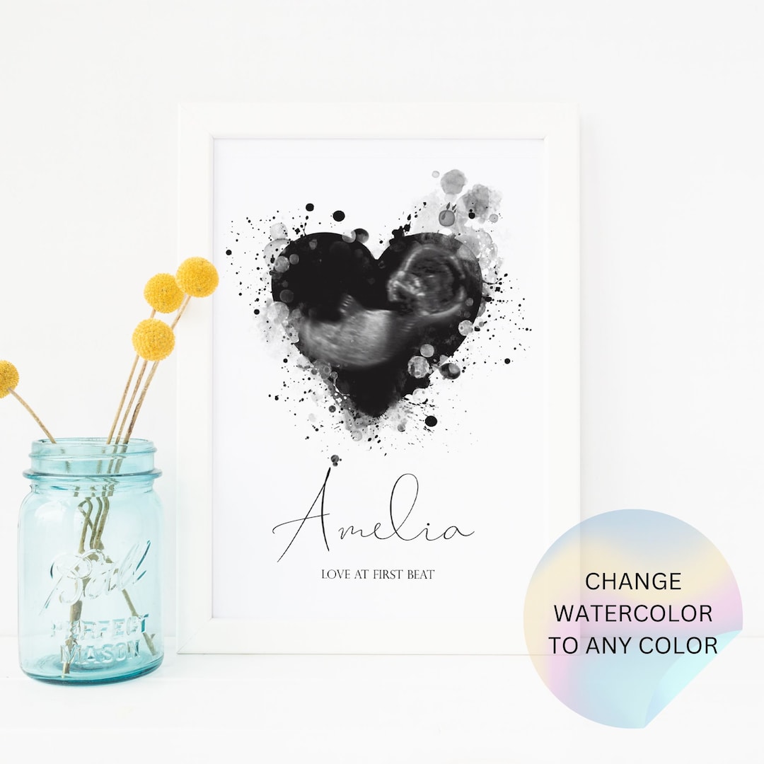 Ultrasound Print Art Watercolor Ultrasound Print Custom Etsy