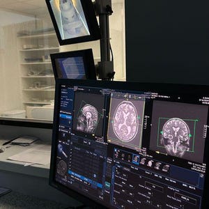May include: A computer monitor displaying medical images of a brain scan. The monitor is connected to a keyboard and mouse. The images are labeled with medical terminology and measurements.