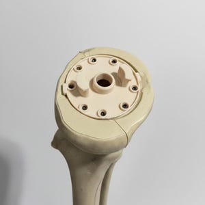 Könnte beinhalten: Beiges anatomisches Modell eines Kniegelenks, das Oberschenkelknochen und Schienbein zeigt. Das Modell hat eine kreisförmige Oberseite mit mehreren kleinen Schrauben und einem zentralen Loch. Die Knochenstruktur ist detailliert und realistisch.
