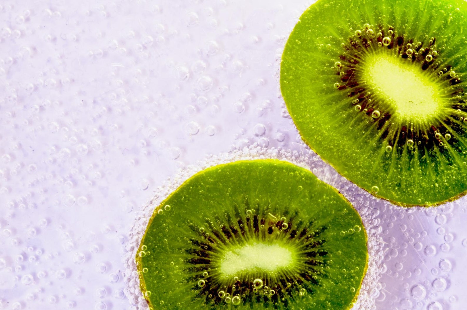 Prolific Kiwi Tree Hardy Kiwi Prolific Plant Self-fertile - Etsy