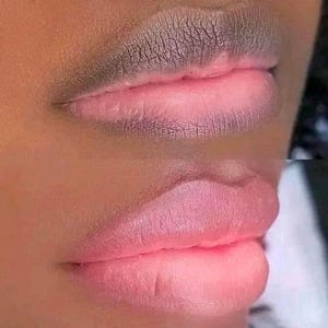 Pink Lip Cream: snel oplichtend voor snelle resultaten 10 ml