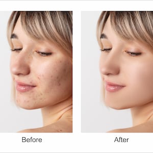 Photo Edit Service Using Photoshop, Professional Phot Editing, Photo Manipulation, Adjust Light, Remove Acne, Whiten Teeth, Color Correction