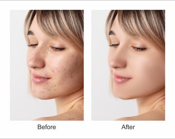 Servicio de edición de fotos con Photoshop, edición profesional de fotos, manipulación de fotos, ajuste de luz, eliminación de acné, blanqueamiento dental, corrección de color