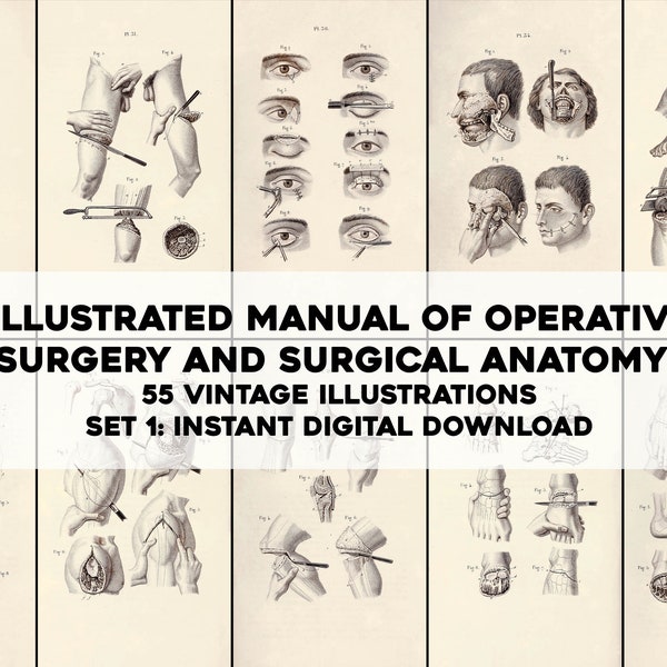 55 Illustrated Operations of Anatomy Phys Medical Surgeon Dissect | Image Bundle Printable Art | Instant Digital Download | Commercial Use