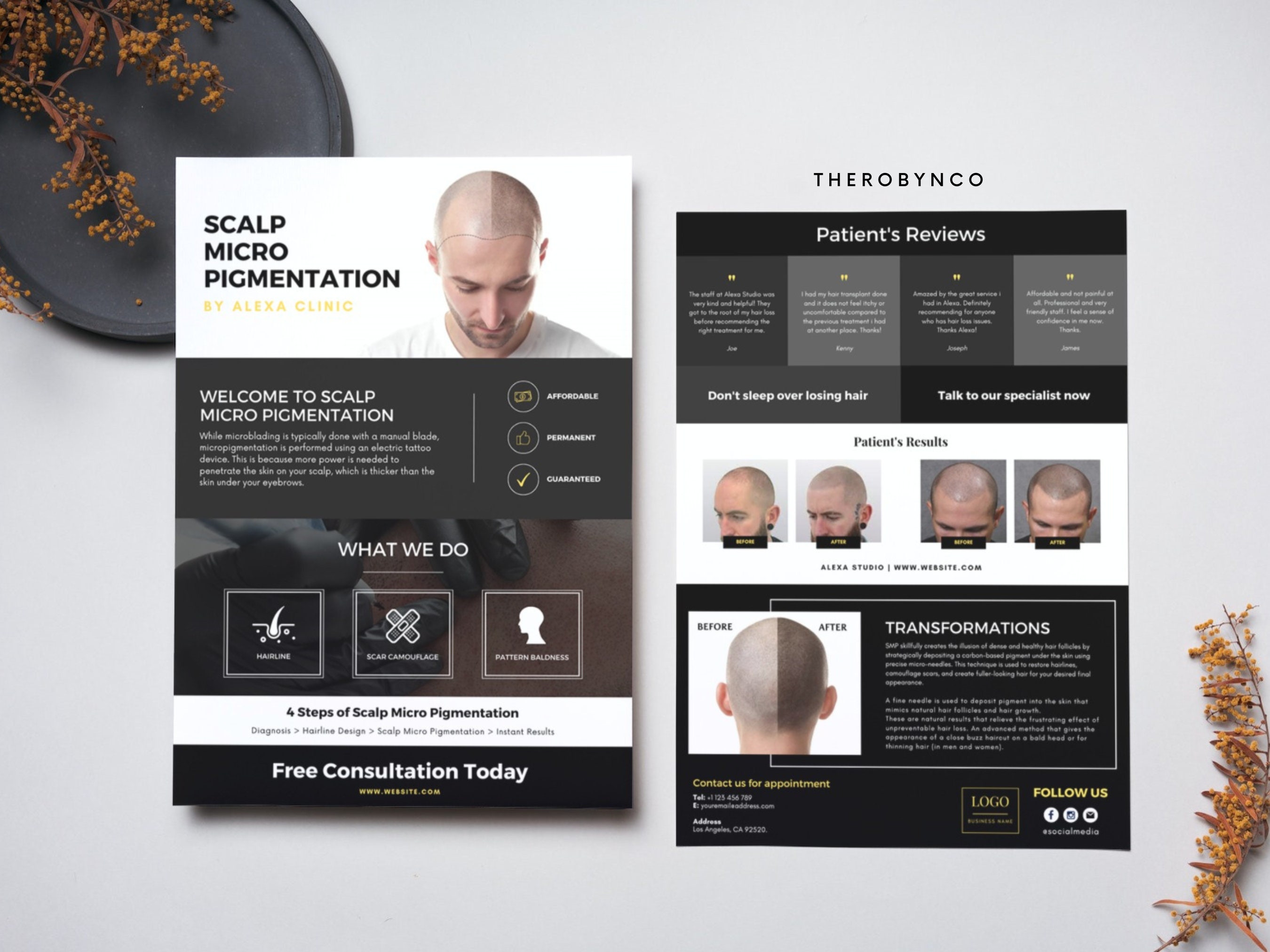 DIY SMP Flyer, Scalp Micropigmentation Flyer Templates Design, Hairline ...