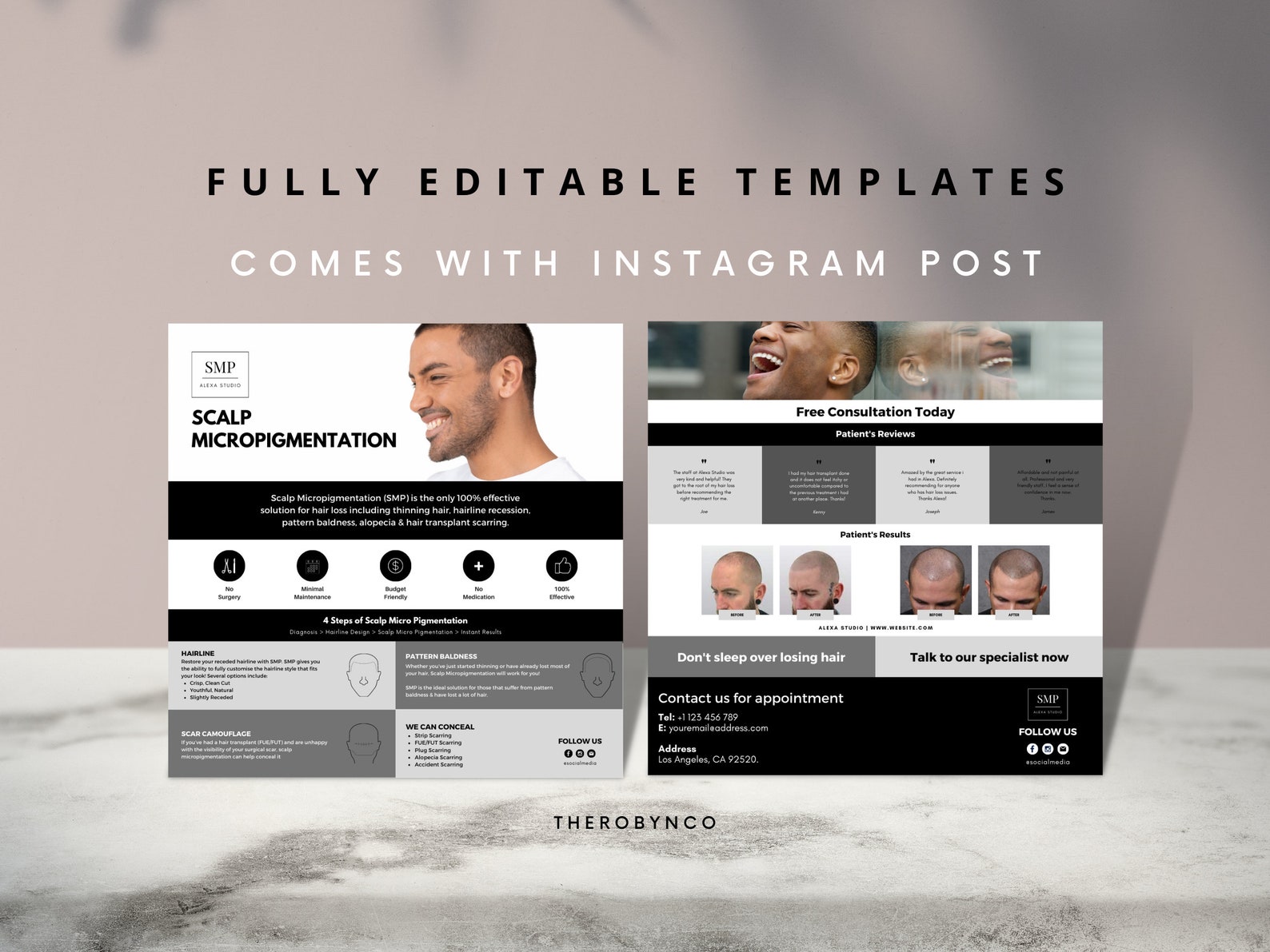 DIY SMP Flyer, Scalp Micropigmentation Flyer Templates Design, Hairline ...