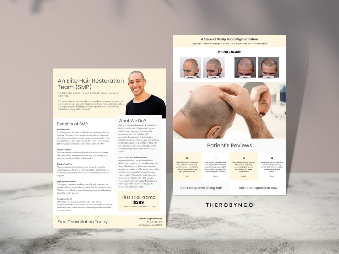 DIY SMP Flyer, Scalp Micropigmentation Flyer Templates Design, Hairline ...