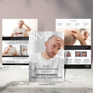 DIY SMP Ulotka, Szablony ulotek mikropigmentacji skóry głowy Projekt, Przeszczep tatuażu linii włosów, Salon skóry głowy, Edytowalny wydruk Instant Canva Men