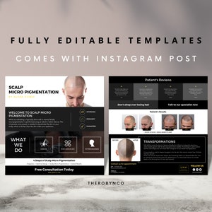 DIY SMP Flyer, Scalp Micropigmentation Flyer Templates Design, Hairline ...