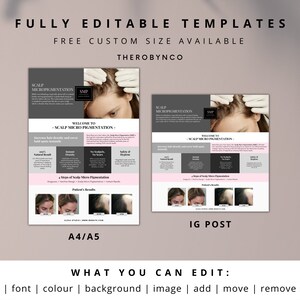 DIY SMP Flyer, Scalp Micropigmentation Flyer Templates Design, Hairline ...