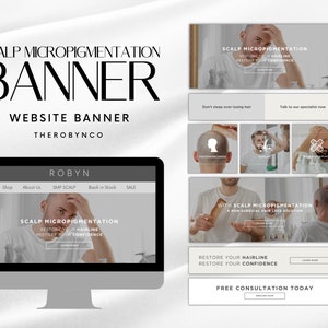 May include: Website banner for a company called "Robyn" that specializes in scalp micropigmentation. The banner features a man with a shaved head and the text "Scalp Micropigmentation: Restore your hairline, restore your confidence".